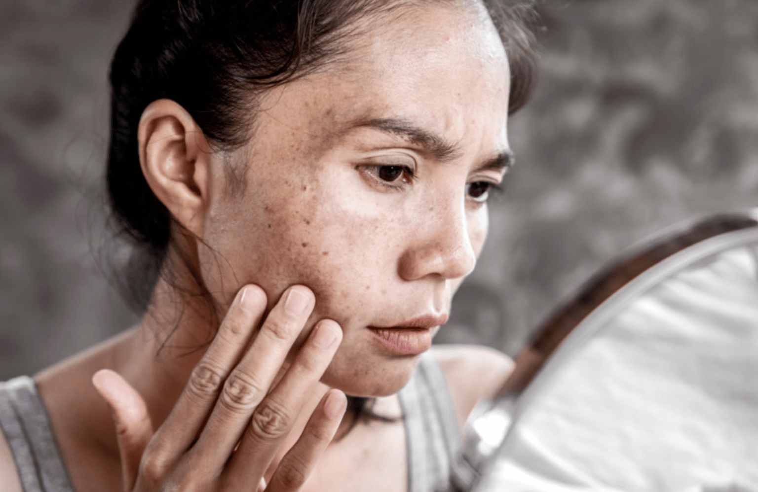 Skin Discoloration, What to Know EzineMark